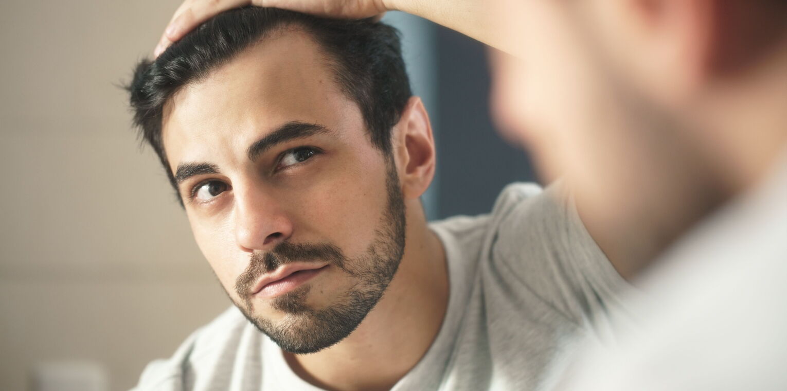 Bild zeigt man mit Haarausfall, der sich im Spiegel anschaut