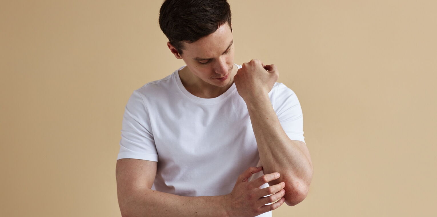 Bild zeigt ein Mann mit Psoriasis am Arm